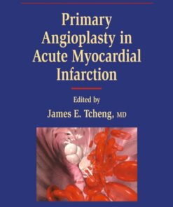Primary Angioplasty in Acute Myocardial Infarction eBook