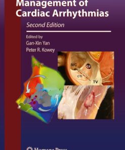 Management of Cardiac Arrhythmias eBook