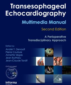 Transesophageal Echocardiography Multimedia Manual: A Perioperative Transdisciplinary Approach eBook