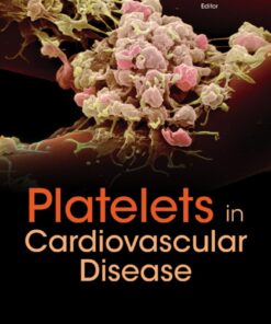 Platelets In Cardiovascular Disease eBook