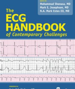 The ECG Handbook of Contemporary Challenges eBook