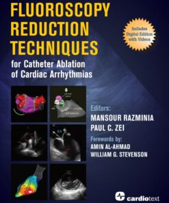 Fluoroscopy Reduction Techniques for Catheter Ablation of Cardiac Arrhythmias eBook
