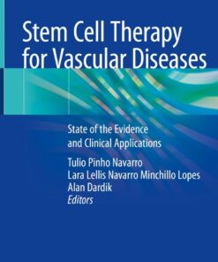 Stem Cell Therapy for Vascular Diseases: State of the Evidence and Clinical Applications eBook