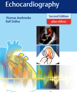 Pocket Atlas of Echocardiography eBook