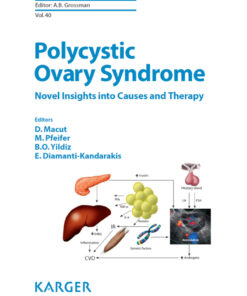 Polycystic Ovary Syndrome eBook