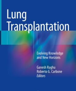 Lung Transplantation: Evolving Knowledge and New Horizons eBook