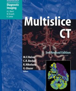 Multislice CT eBook