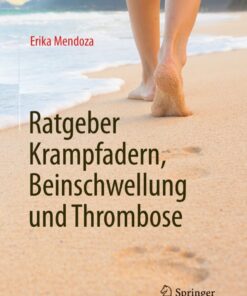 Ratgeber Krampfadern, Beinschwellung und Thrombose eBook