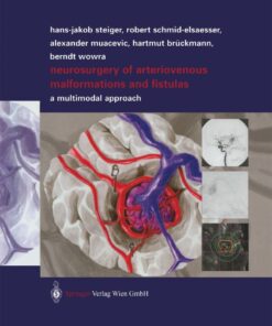 Neurosurgery of Arteriovenous Malformations and Fistulas: A Multimodal Approach eBook