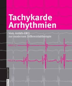 Tachykarde Arrhythmien: Vom Anfalls-EKG zur modernen Differentialtherapie eBook