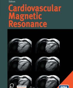 Cardiovascular Magnetic Resonance eBook