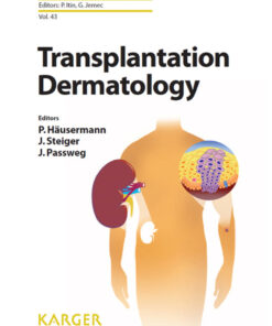 Transplantation Dermatology eBook