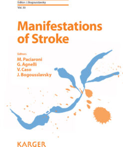 Manifestations of Stroke eBook