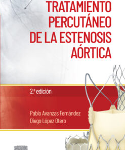 Manual de tratamiento percutáneo de la estenosis aórtica eBook