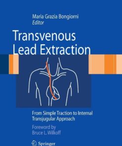 Transvenous Lead Extraction: From Simple Traction to Internal Transjugular Approach eBook