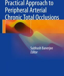 Practical Approach to Peripheral Arterial Chronic Total Occlusions eBook