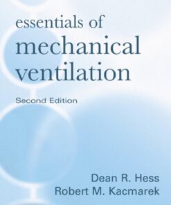Essentials of Mechanical Ventilation eBook