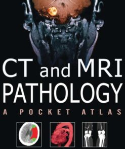 CT & MRI Pathology: A Pocket Atlas, Second Edition eBook