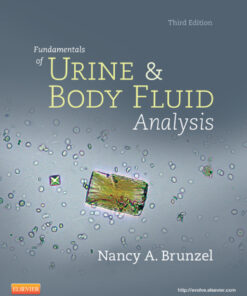 Fundamentals of Urine and Body Fluid Analysis eBook
