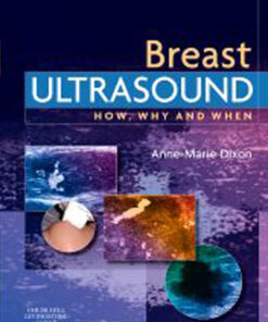 E-Book - Breast Ultrasound: How, Why and When eBook