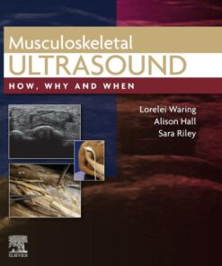 Musculoskeletal Ultrasound: How, Why and When eBook