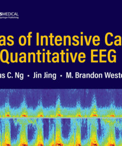 Atlas of Intensive Care Quantitative EEG eBook