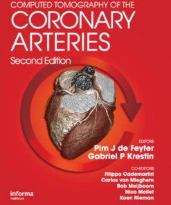 Computed Tomography of the Coronary Arteries eBook