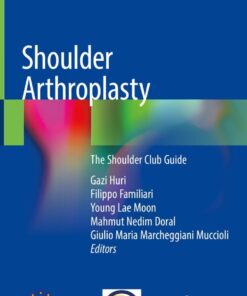Shoulder Arthroplasty: The Shoulder Club Guide eBook