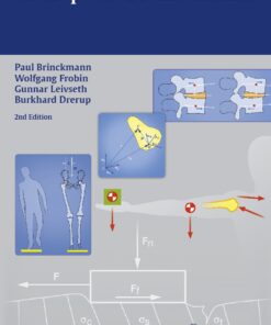 Orthopedic Biomechanics eBook