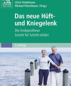Die Endoprothese: Die Endoprothese Schritt für Schritt erklärt eBook