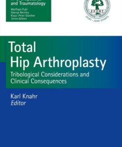 Total Hip Arthroplasty: Tribological Considerations and Clinical Consequences eBook