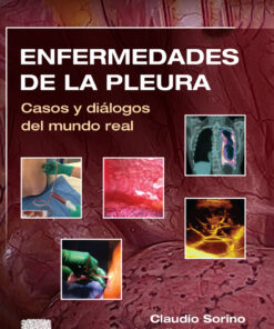 Enfermedades de la pleura: Casos y diálogos del mundo real eBook