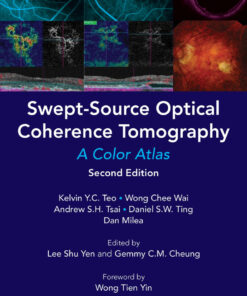 SWEPT-SOURCE OPTICAL COHERENCE TOMOGRAPHY: A COLOR ATLAS (SECOND EDITION)A Color Atlas eBook