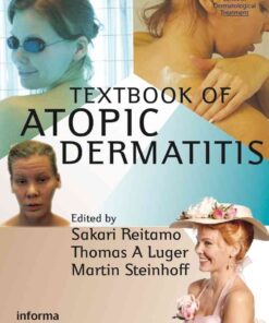 Textbook of Atopic Dermatitis eBook