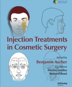 Injection Treatments in Cosmetic Surgery eBook
