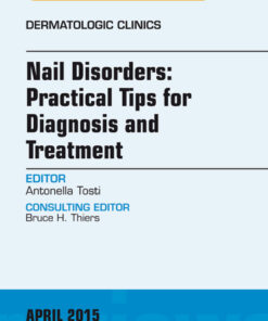 Nail Disorders: Practical Tips for Diagnosis and Treatment, An Issue of Dermatologic Clinics eBook