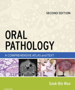 Oral Pathology: A Comprehensive Atlas and Text eBook