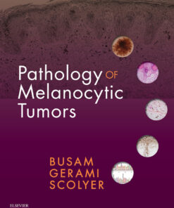 Pathology of Melanocytic Tumors eBook