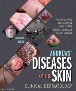 Andrews' Diseases of the Skin Clinical Dermatology eBook