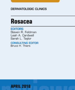Rosacea, An Issue of Dermatologic Clinics eBook