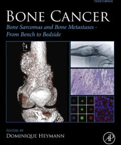 Bone Cancer: Bone Sarcomas and Bone Metastases - From Bench to Bedside eBook