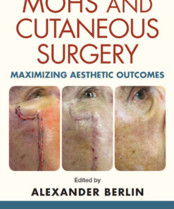 Mohs and Cutaneous Surgery: Maximizing Aesthetic Outcomes eBook