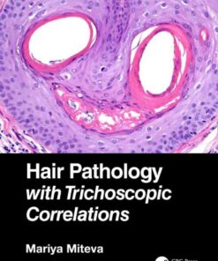 Hair Pathology with Trichoscopic Correlations eBook