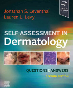 Self-Assessment in Dermatology: Questions and Answers eBook