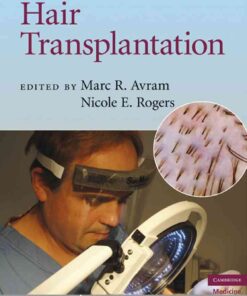 Hair Transplantation eBook