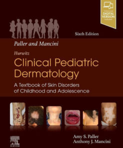 Paller and Mancini - Hurwitz Clinical Pediatric Dermatology: A Textbook of Skin Disorders of Childhood and Adolescence eBook