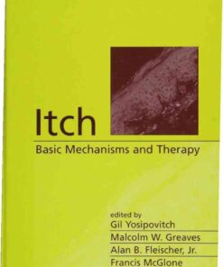 Itch: Basic Mechanisms and Therapy eBook