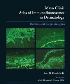 Mayo Clinic Atlas of Immunofluorescence in Dermatology: Patterns and Target Antigens eBook