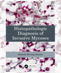 Histopathologic Diagnosis of Invasive Mycoses eBook