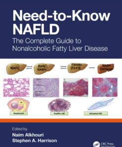 Need-to-Know NAFLD: The Complete Guide to Nonalcoholic Fatty Liver Disease eBook
